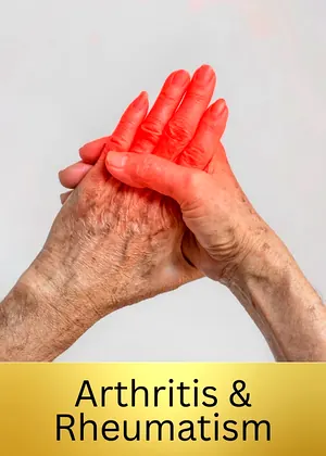 Joint Pain care Unani products at Unani Wellness
